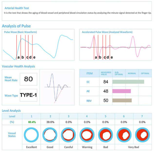 AVACEN Cardiovascular & Stress Screening (CSS) System w/3YR Warranty